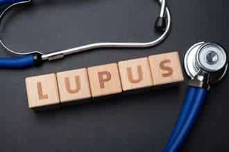 how lupus affects the skin 633c1e0790b95