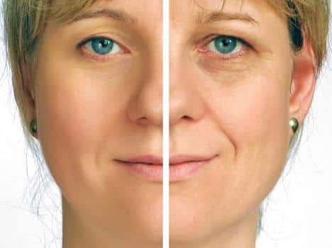 preventing wrinkles 633c1eb24f776