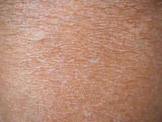 why is my skin so dry 633c1e3d31285